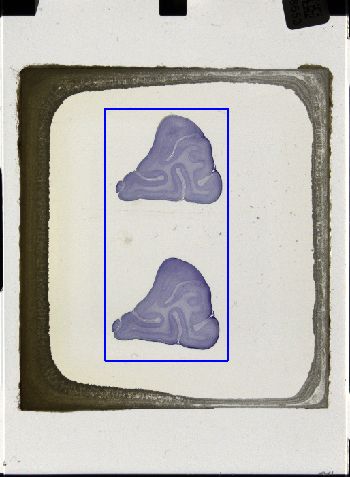 Media type: image; Special Collections 3043   shows specimen_part histological serial section;